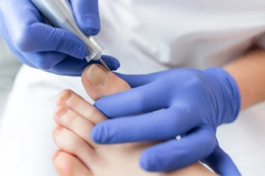 Pedicure aan het frezen